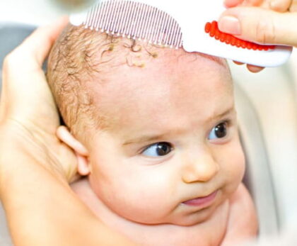 bebeklerde konak nasıl geçer